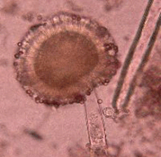 Aspergillus niger