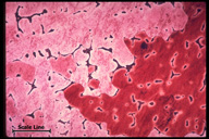 Copper Microstructures 