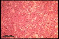 Microstructure