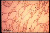 Microstructure