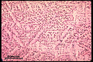 Microstructure