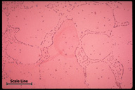 Microstructure